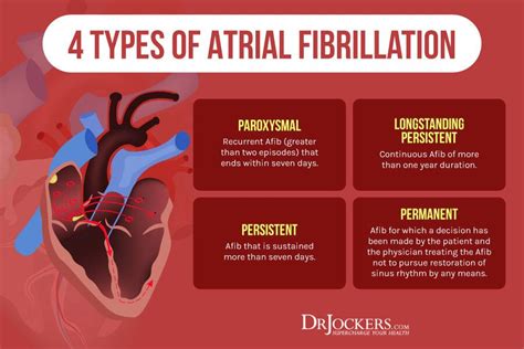 Atrial Fibrillation: Causes, Symptoms & Natural Support Strategies ...