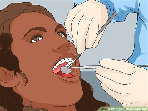 How to Get Rid of a Gum Boil: 10 Steps (with Pictures) - wikiHow