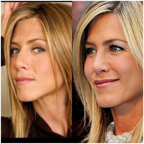 Jennifer Aniston Nose Job Before and After