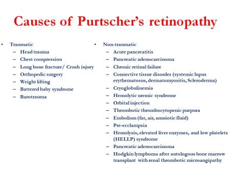 Purtscher Retinopathy and Purtscher-like Retinopathy - EyeWiki