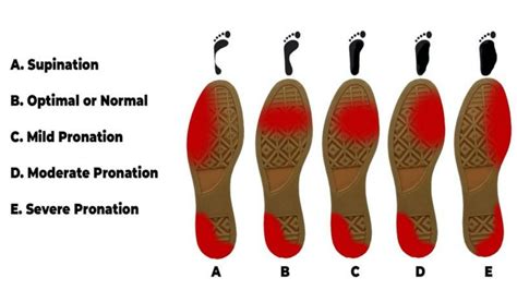 Pronation And Supination Whats All That About - Ariki Holidays