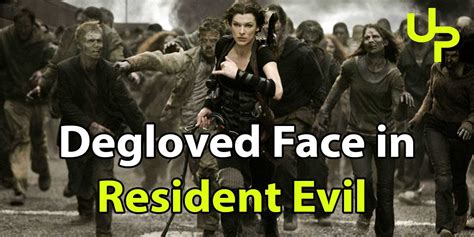 Degloved Face in Resident Evil: A Gory and Gripping Tale