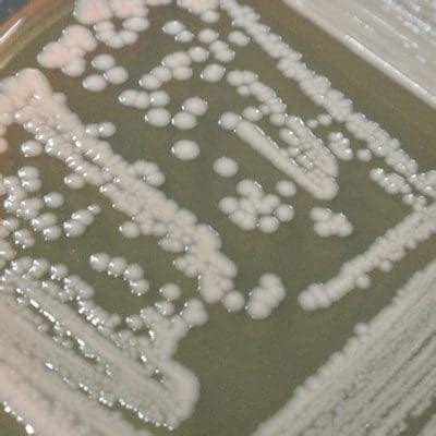 Enterobacter Aerogenes Morphology