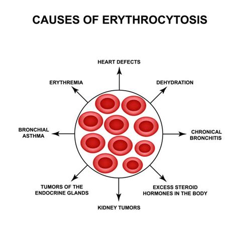 Erythropoietin Illustrations, Royalty-Free Vector Graphics & Clip Art ...