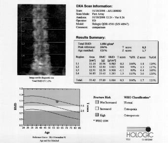 DEXA (Bone Density) • ImageCare Medical Imaging