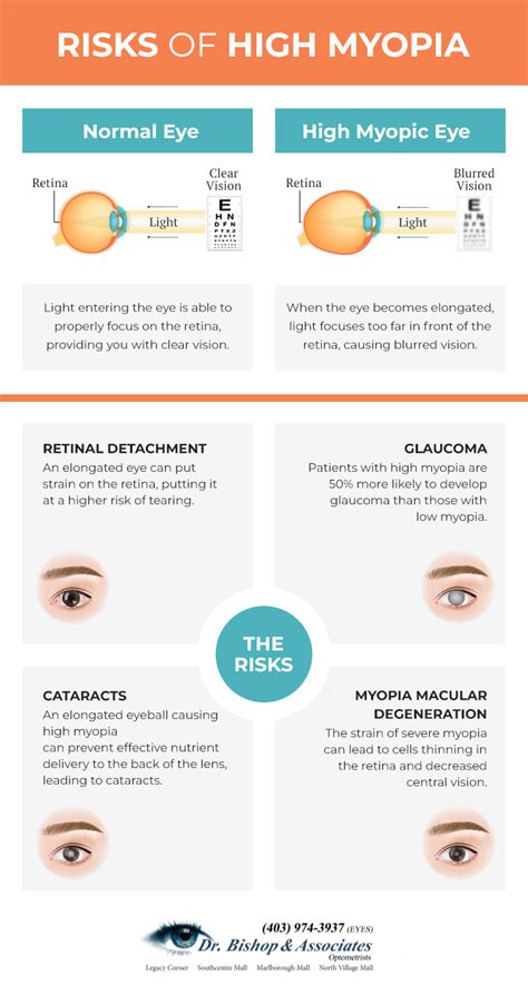 What is High Myopia & Can it Cause Blindness? | Calgary