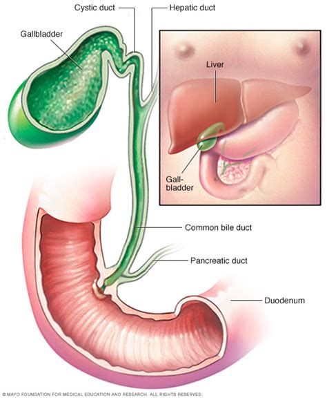 Cholangiocarcinoma (bile duct cancer) - Symptoms and causes - Mayo Clinic