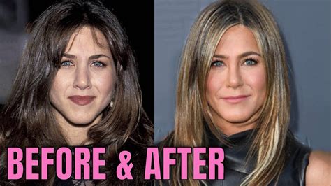 Jennifer Aniston: Plastic Surgery (2020) - YouTube