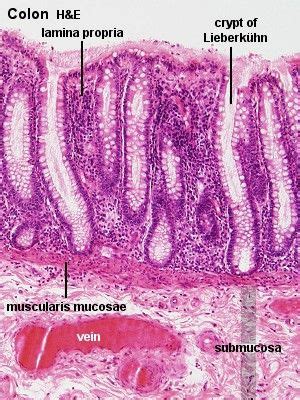 Gastrointestinal Tract - Colon Histology - Embryology | Histology ...