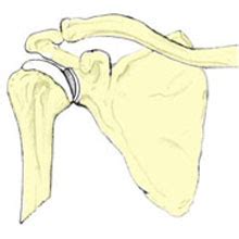 Scapula Fracture | Symptoms, causes & treatment explained