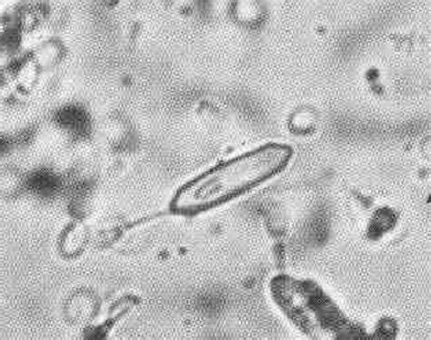 What Causes Calcium Oxalate Crystals In Urine In Dogs