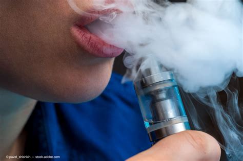 Chest Imaging Reveals Traits of Vaping-Related Lung Injuries in Teens