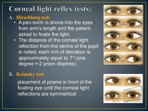 Strabismus-Clinical Examinations