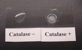 Catalase test: Principle, Procedure, Results, Uses • Microbe Online