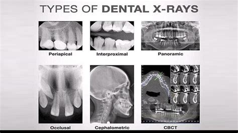 Dental Radiography