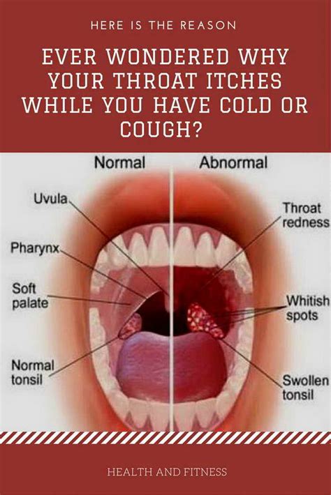 Ever Wondered Why Your Throat Itches While You Have Cold Or Cough? Here ...