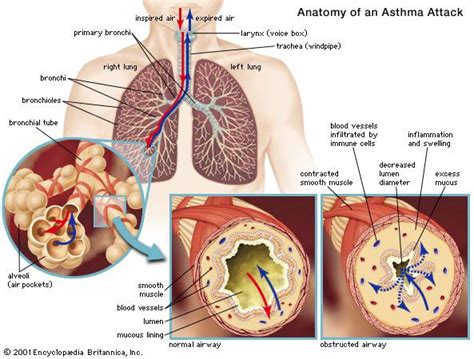 Respiratory disease | Definition, Causes, & Major Types | Britannica