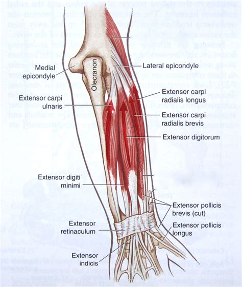 tendinopathy - Why do tennis elbow (epicondylitis) mostly affect the ...