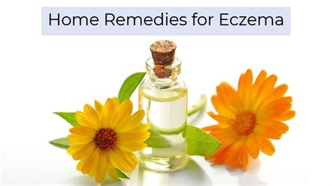 What Are The Best Home Remedies For Eczema?