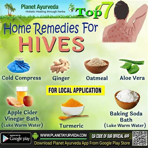 Hives In Babies Home Remedy - BABBIES CIP