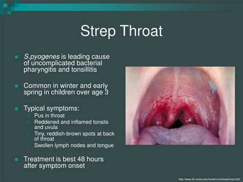 PPT - Streptococcus pyogenes PowerPoint Presentation, free download ...