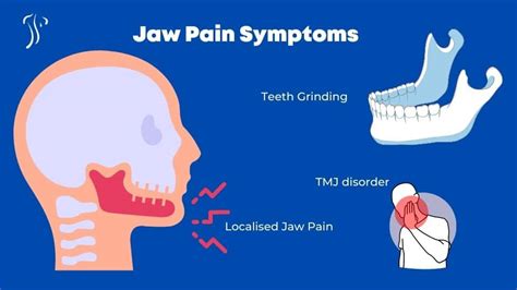 Jaw Pain Relief | TMJ Pain, Symptoms & Treatment | Dublin