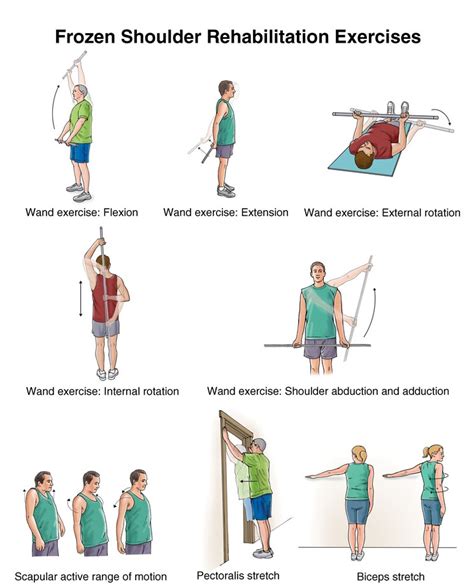 Stroke Wise: Improving shoulder pain