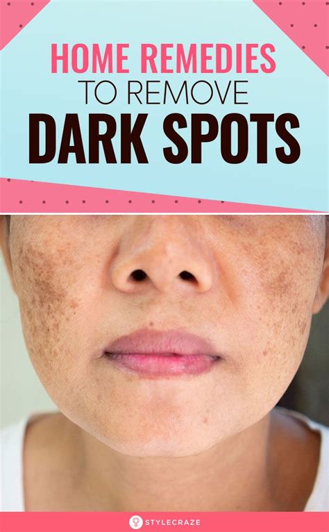 6 Home Remedies To Remove Dark Spots On The Face: If you have ...