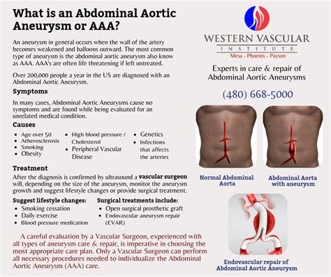 Pin by Christina Gehling on Job in 2021 | Aortic aneurysm, Abdominal ...