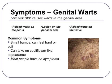 Understanding Genital Warts: Causes, Symptoms, and Treatment - Ask The ...