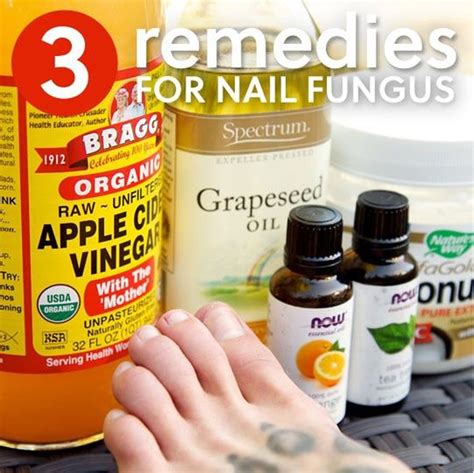 What Kills Nail Fungus Fast? Everything You Need To Know About Nail Fungus