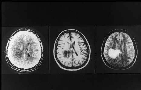 Ultrasound, MRI and CT Scan - What's the Difference? - Probo Medical UK