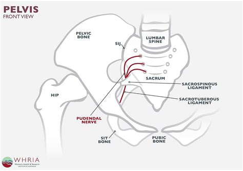 Pudendal Nerve Ablation Procedure - mapasgmaes