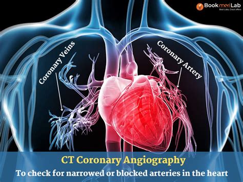 CT Coronary Angiography: Purpose, Procedure, Report & Price [2024]