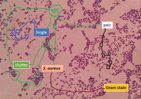 Gram Positive Cocci In Clusters Staph Aureus