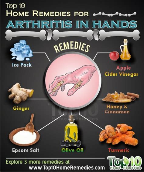 Home Remedies for Arthritis in Hands | Top 10 Home Remedies