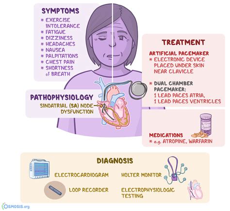 Sick Sinus Syndrome: What Is It, Symptoms, Causes | Osmosis