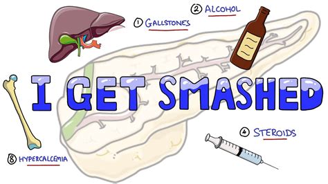 Causes of Acute Pancreatitis Mnemonic I GET SMASHED | What are the ...