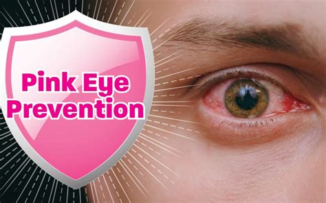 Pink Eye Prevention | Causes and Symptoms of Pink Eye Infection