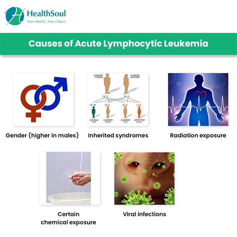 Acute Lymphocytic Leukemia: Symptoms and Treatment | Hematology ...