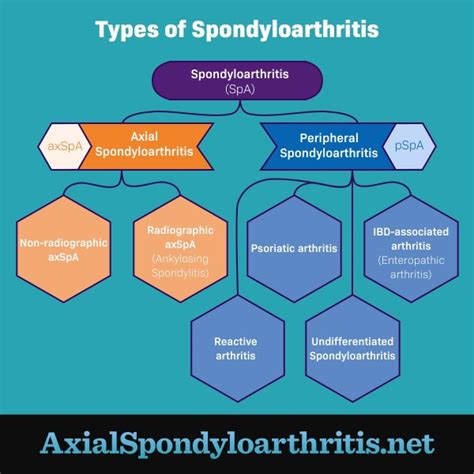 Exploring the Diverse Types of Spondyloarthritis