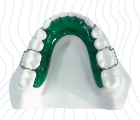 Spring Hawley Retainers—Removable Clear Orthodontic Retainers