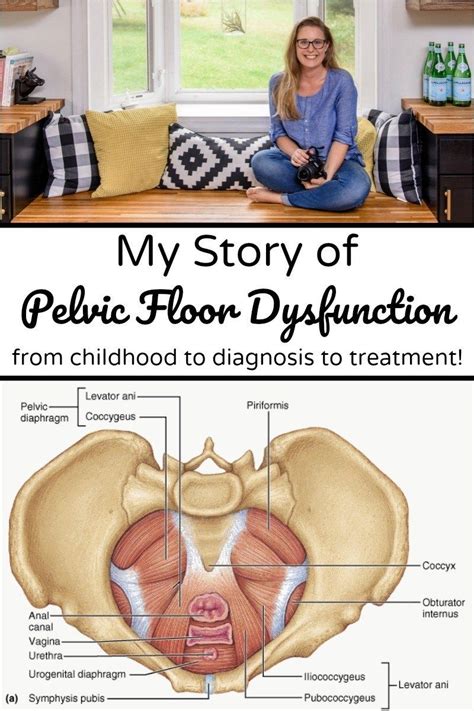 My Story of Pelvic Floor Dysfunction: from Childhood to Diagnosis to ...