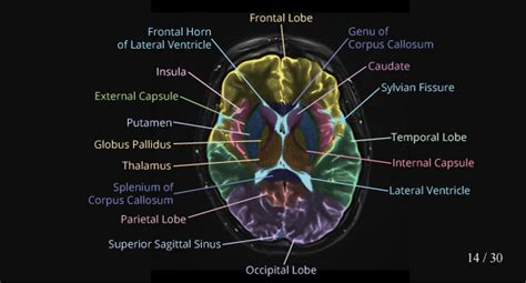 Mri Images Of The Brain