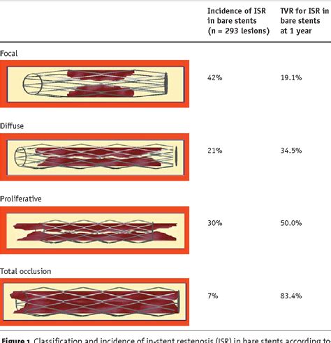 Figure 1 from Herz Classification and Current Treatment Options of In ...