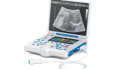 5 best portable ultrasound machines » TheHealthDiary.com