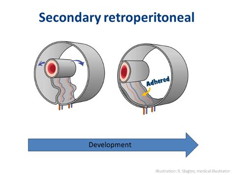 Retroperitoneal Organs