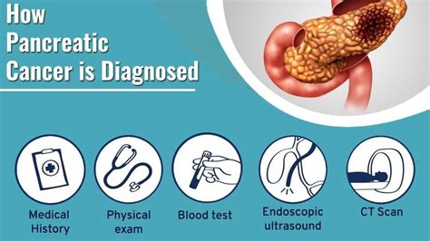 Learn Pancreatic Cancer Treatment and Surgery by Top Pancreatic Surgeon ...