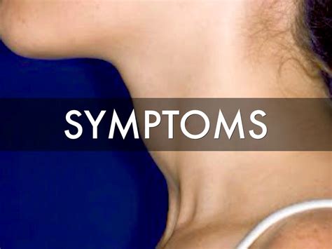 Thyroid Problem Symptoms: Thyroid Cancer Symptoms