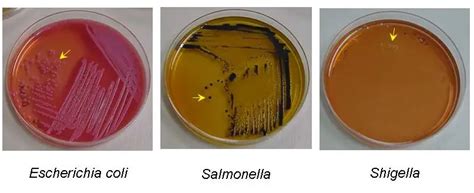 Salmonella-Shigella (SS) Agar: Composition, Principle and Results ...